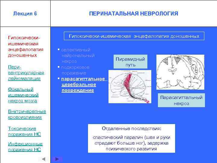 Лекция 6 ПЕРИНАТАЛЬНАЯ НЕВРОЛОГИЯ Гипоксическиишемическая энцефалопатия доношенных Гипоксически-ишемическая энцефалопатия доношенных Перивентрикулярная лейкомаляция Фокальный ишемический