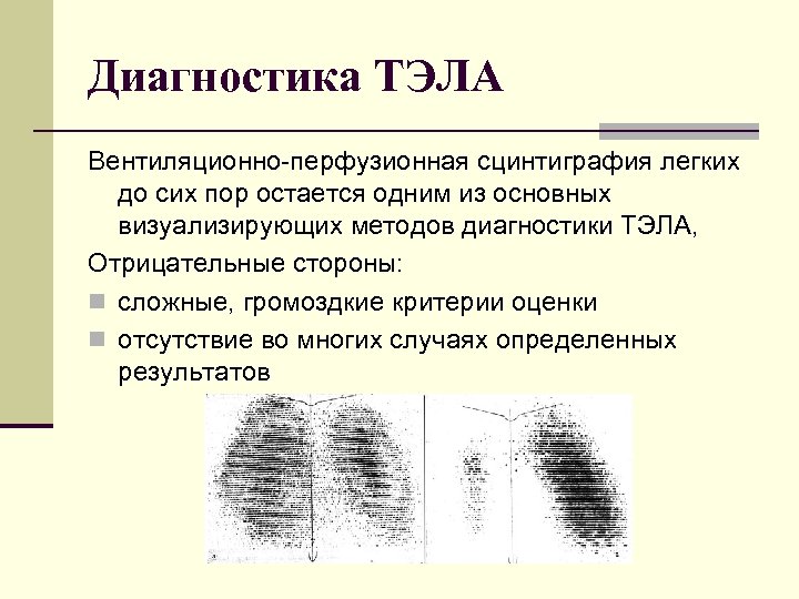Диагностика ТЭЛА Вентиляционно перфузионная сцинтиграфия легких до сих пор остается одним из основных визуализирующих