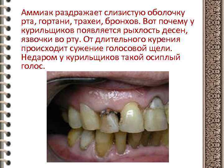 Аммиак раздражает слизистую оболочку рта, гортани, трахеи, бронхов. Вот почему у курильщиков появляется рыхлость