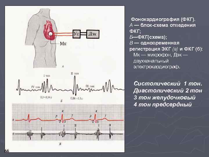 Регистрация сердца. Сопоставление ЭКГ И ФКГ. Фонокардиография. Фонокардиограмма.. ФКГ принцип метода. ФКГ 1 тон.