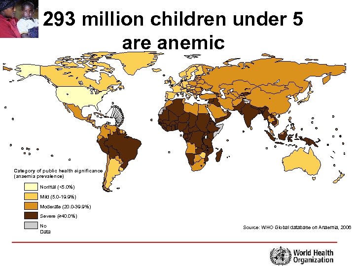 293 million children under 5 are anemic Category of public health significance (anaemia prevalence)