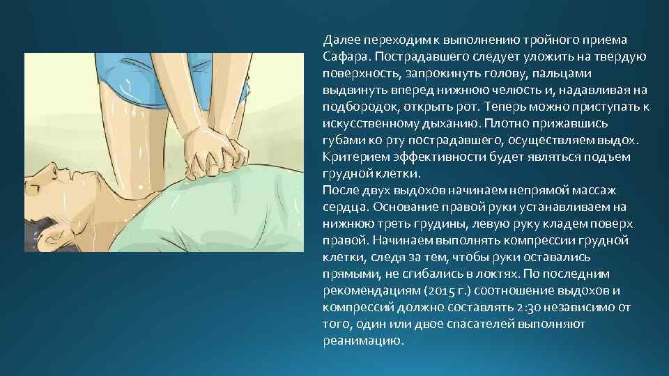 Далее переходим к выполнению тройного приема Сафара. Пострадавшего следует уложить на твердую поверхность, запрокинуть