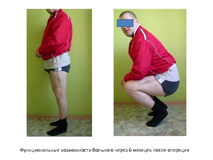 Функциональные возможности больного через 6 месяцев после операции 