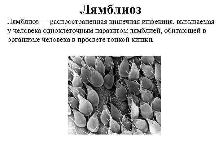 Лямблиоз — распространенная кишечная инфекция, вызываемая у человека одноклеточным паразитом лямблией, обитающей в организме