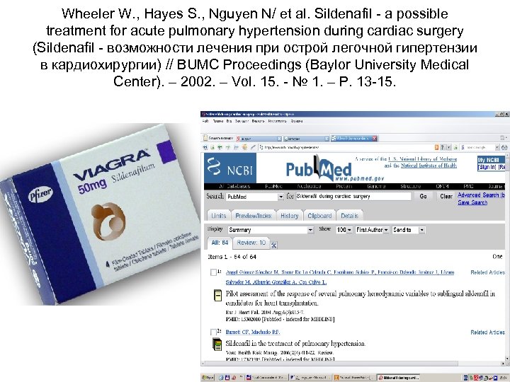 Wheeler W. , Hayes S. , Nguyen N/ et al. Sildenafil a possible treatment