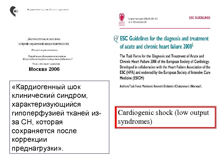  «Кардиогенный шок клинический синдром, характеризующийся гипоперфузией тканей из за СН, которая сохраняется после