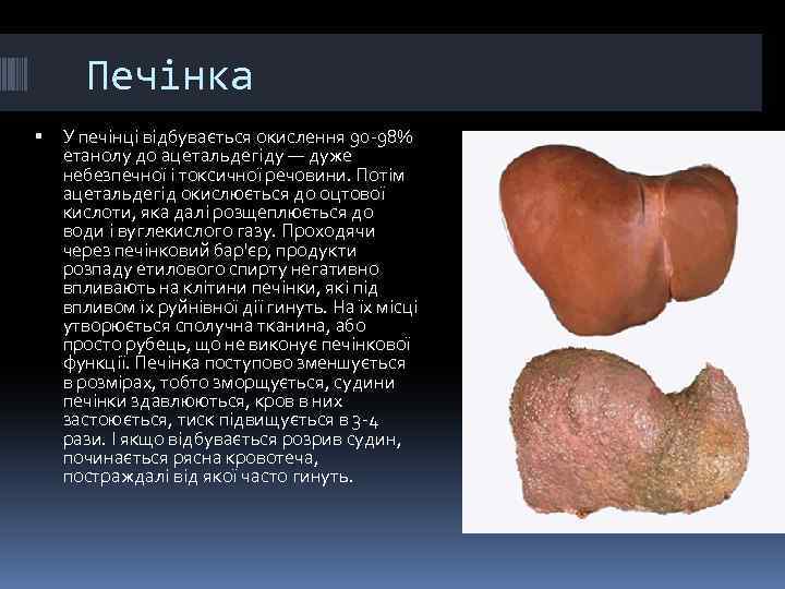 Печінка У печінці відбувається окислення 90 -98% етанолу до ацетальдегіду — дуже небезпечної і