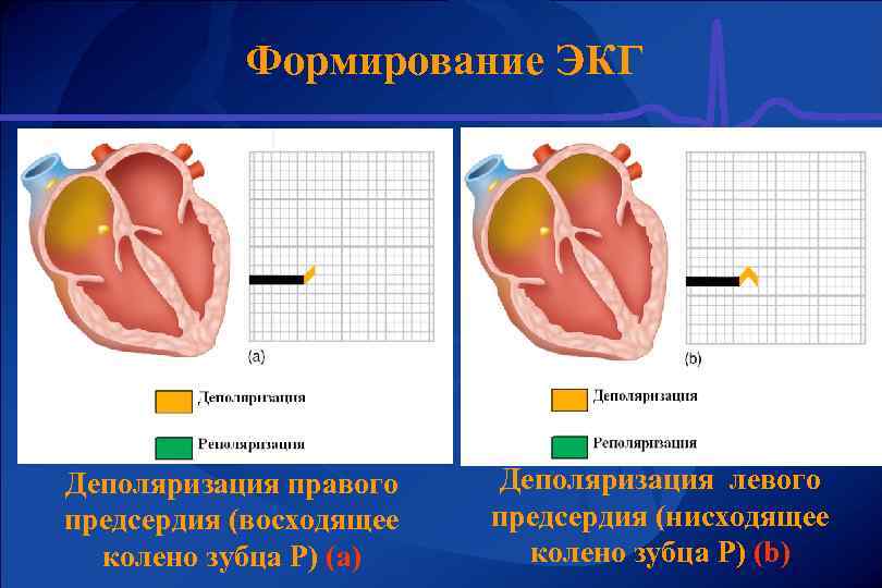 Формирование ЭКГ Деполяризация правого предсердия (восходящее колено зубца Р) (а) Деполяризация левого предсердия (нисходящее