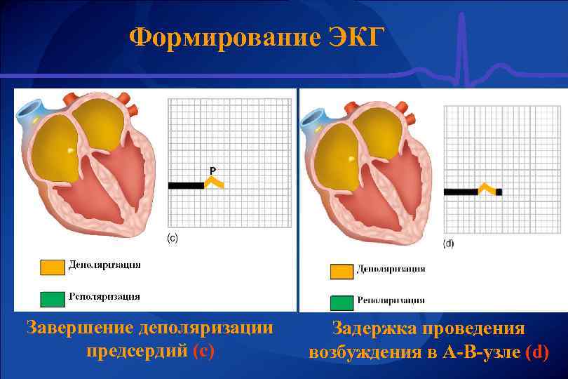 Формирование ЭКГ Завершение деполяризации предсердий (с) Задержка проведения возбуждения в А-В-узле (d) 