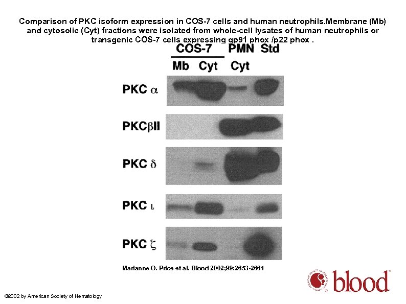 Comparison of PKC isoform expression in COS-7 cells and human neutrophils. Membrane (Mb) and