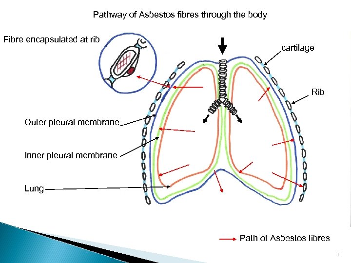 Pathway of Asbestos fibres through the body Fibre encapsulated at rib cartilage Rib Outer