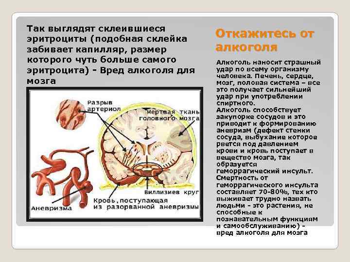 Так выглядят склеившиеся эритроциты (подобная склейка забивает капилляр, размер которого чуть больше самого эритроцита)