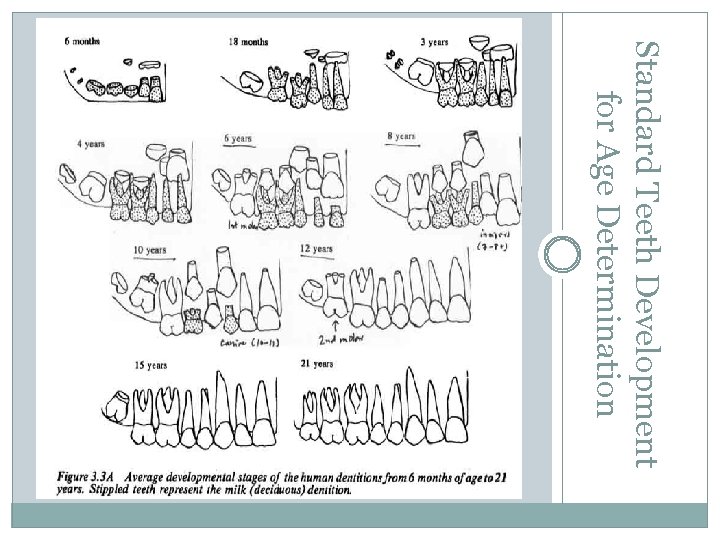 Standard Teeth Development for Age Determination 