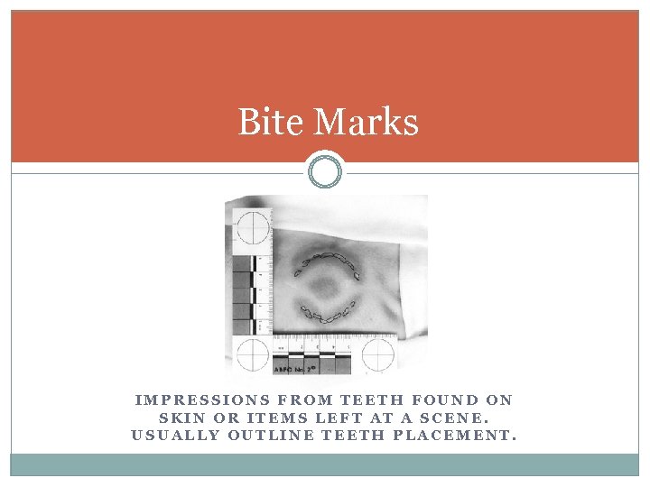 Bite Marks IMPRESSIONS FROM TEETH FOUND ON SKIN OR ITEMS LEFT AT A SCENE.