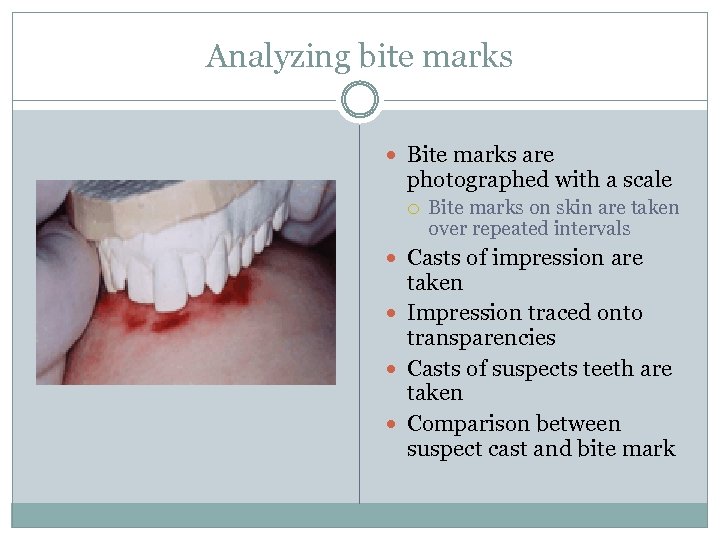 Analyzing bite marks Bite marks are photographed with a scale Bite marks on skin