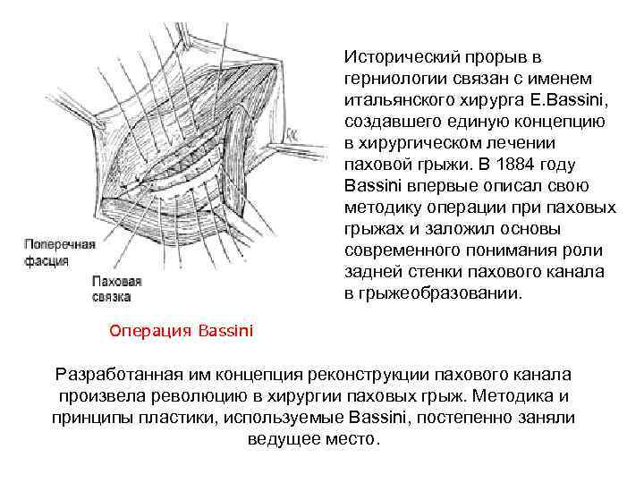 Пластика бедренного канала