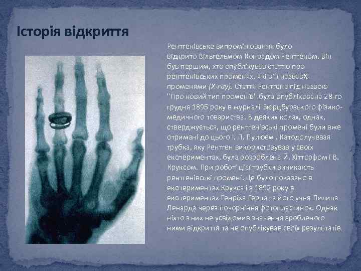 Історія відкриття Рентгенівське випромінювання було відкрито Вільгельмом Конрадом Рентгеном. Він був першим, хто опублікував