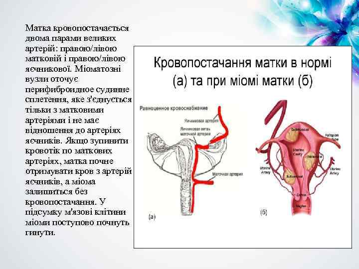 Матка кровопостачається двома парами великих артерій: правою/лівою матковій і правою/лівою яєчникової. Міоматозні вузли оточує