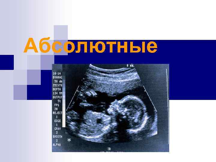 Абсолютные 