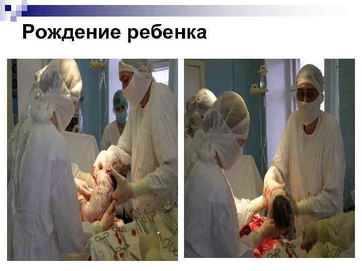 Рождение ребенка 