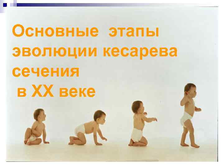 Основные этапы эволюции кесарева сечения в ХХ веке 
