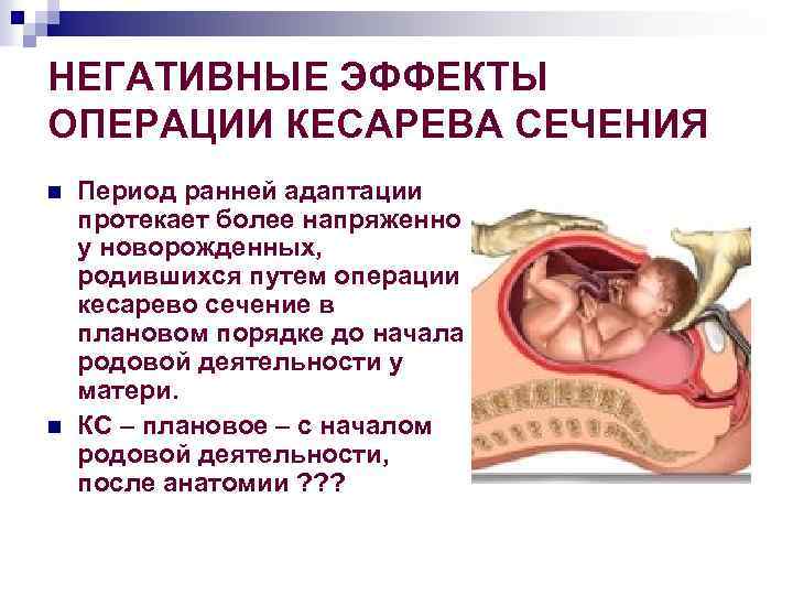 НЕГАТИВНЫЕ ЭФФЕКТЫ ОПЕРАЦИИ КЕСАРЕВА СЕЧЕНИЯ n n Период ранней адаптации протекает более напряженно у