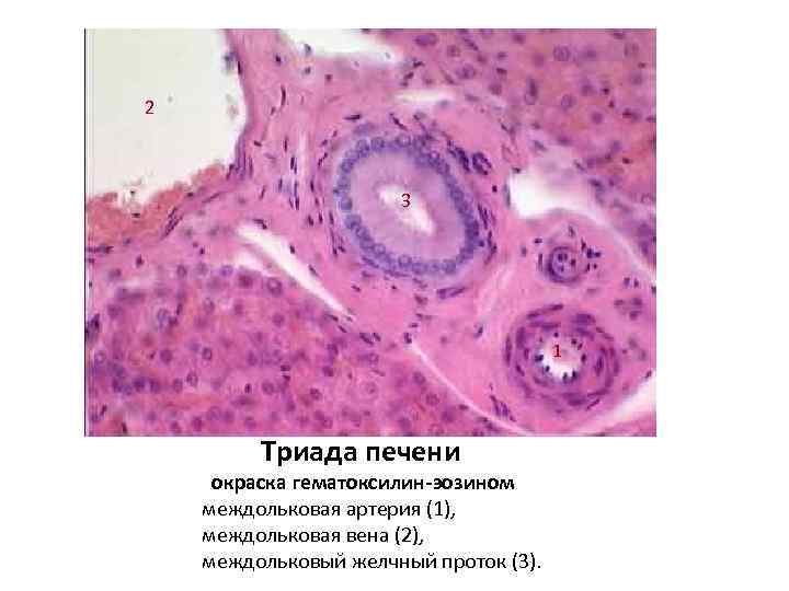 2 3 1 Триада печени окраска гематоксилин-эозином междольковая артерия (1), междольковая вена (2), междольковый