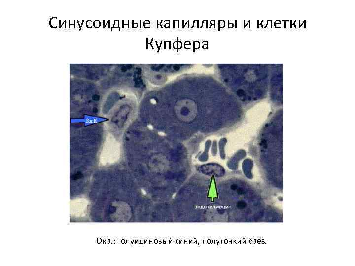 Синусоидные капилляры и клетки Купфера Окр. : толуидиновый синий, полутонкий срез. 