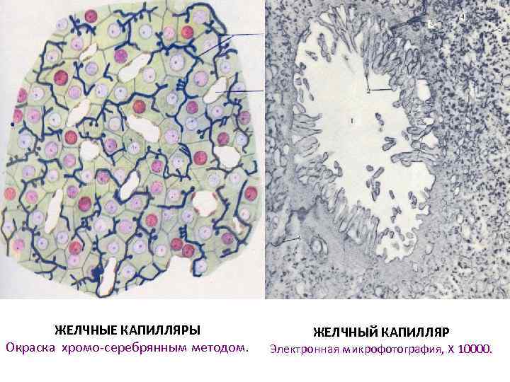 ЖЕЛЧНЫЕ КАПИЛЛЯРЫ Окраска хромо-серебрянным методом. ЖЕЛЧНЫй КАПИЛЛЯР Электронная микрофотография, X 10000. 