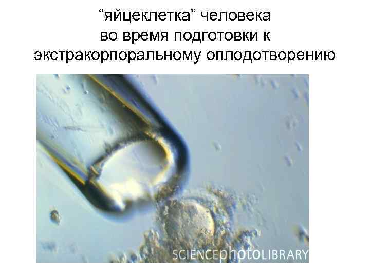 “яйцеклетка” человека во время подготовки к экстракорпоральному оплодотворению 