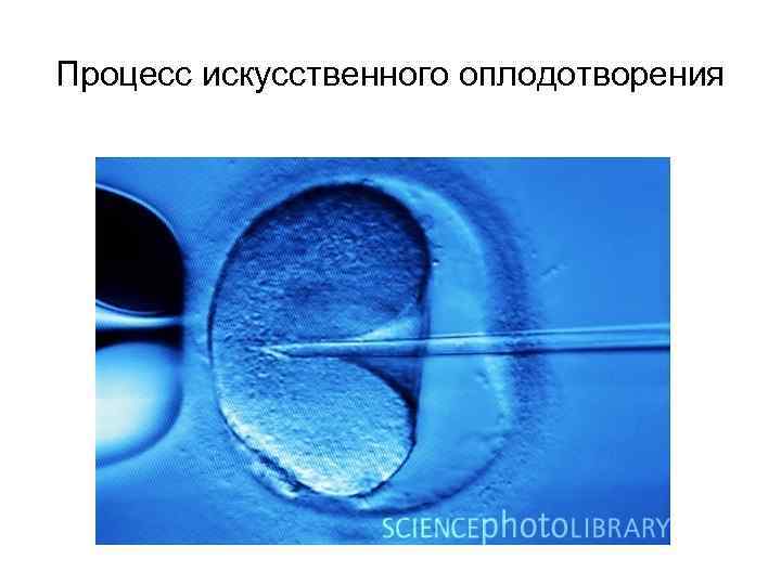 Процесс искусственного оплодотворения 