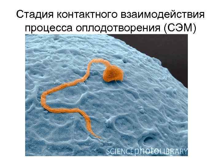 Стадия контактного взаимодействия процесса оплодотворения (СЭМ) 