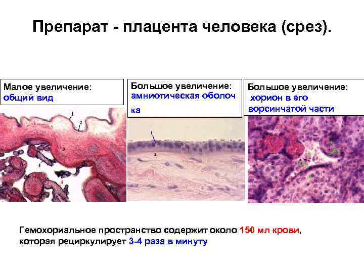 Препарат - плацента человека (срез). Малое увеличение: общий вид Большое увеличение: амниотическая оболоч ка