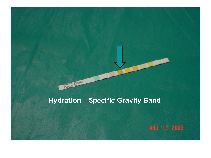 Hydratin – Specific Gravity Band Hydration—Specific Gravity Band 