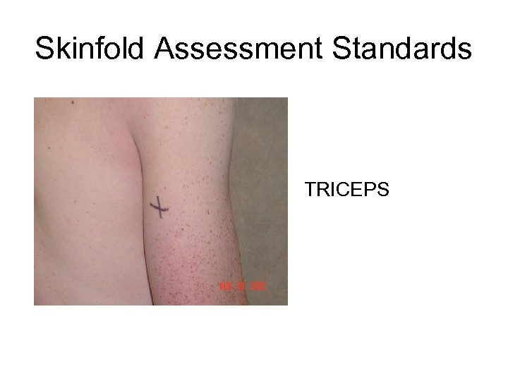 Skinfold Assessment Standards • TRICEPS 