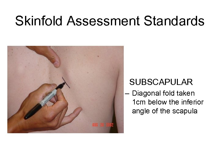 Skinfold Assessment Standards • SUBSCAPULAR – Diagonal fold taken 1 cm below the inferior