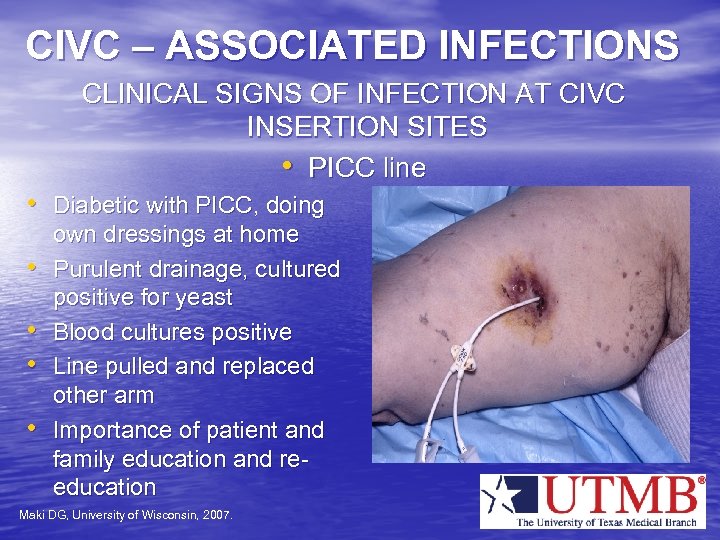 CIVC – ASSOCIATED INFECTIONS CLINICAL SIGNS OF INFECTION AT CIVC INSERTION SITES • PICC