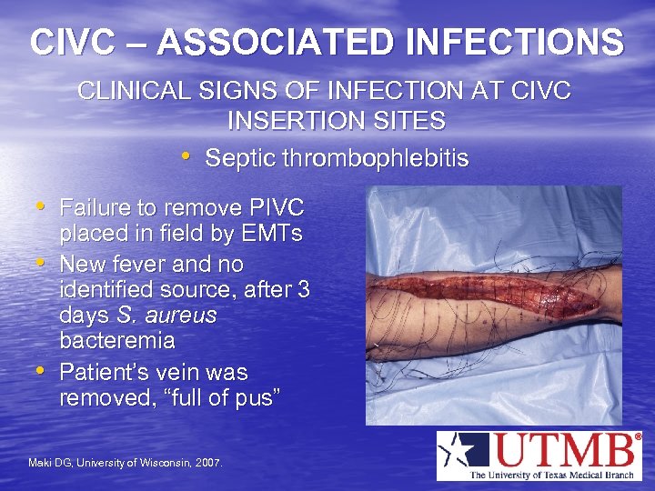 CIVC – ASSOCIATED INFECTIONS CLINICAL SIGNS OF INFECTION AT CIVC INSERTION SITES • Septic