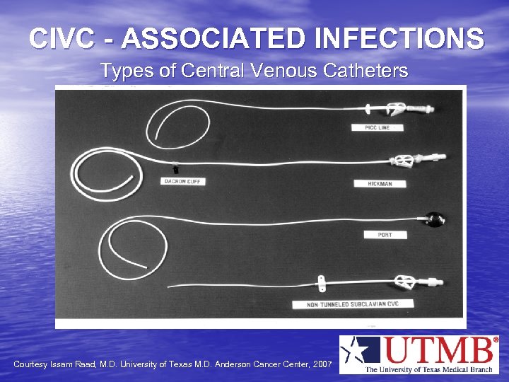 CIVC - ASSOCIATED INFECTIONS Types of Central Venous Catheters Courtesy Issam Raad, M. D.