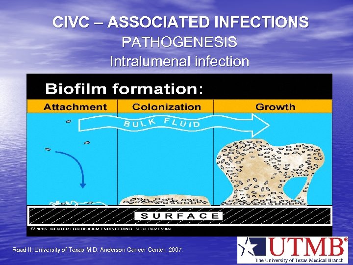 CIVC – ASSOCIATED INFECTIONS PATHOGENESIS Intralumenal infection Raad II, University of Texas M. D.