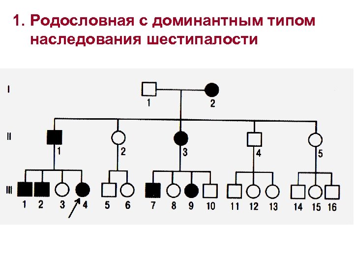 Родословная биология 11 класс. Родословная с аутосомно-доминантным типом наследования. Схема родословной на аутосомно-доминантный Тип наследования. Родословная по аутосомно доминантному типу наследования. Тип наследования у шестипалости.