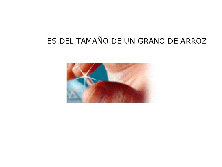 ES DEL TAMAÑO DE UN GRANO DE ARROZ 