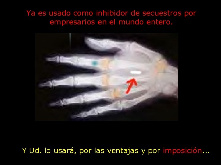 Ya es usado como inhibidor de secuestros por empresarios en el mundo entero. Y