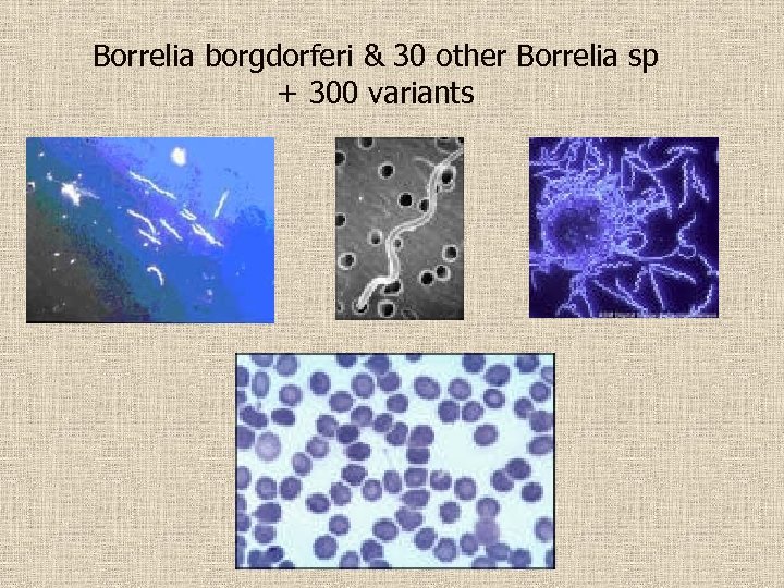 Borrelia borgdorferi & 30 other Borrelia sp + 300 variants 