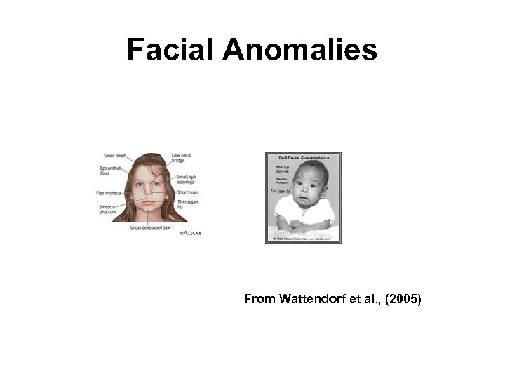 Facial Anomalies From Wattendorf et al. , (2005) 