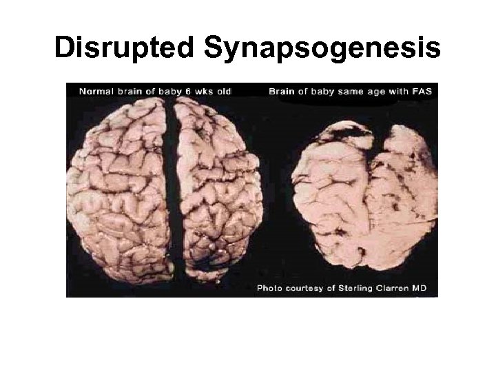 Disrupted Synapsogenesis 
