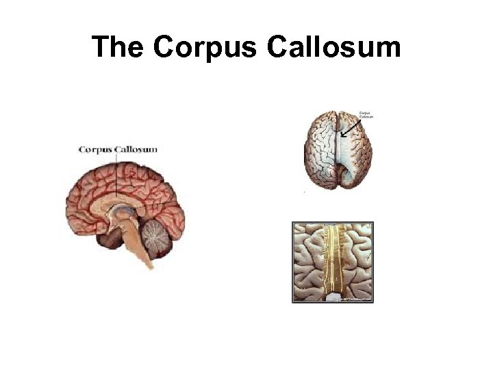 The Corpus Callosum 