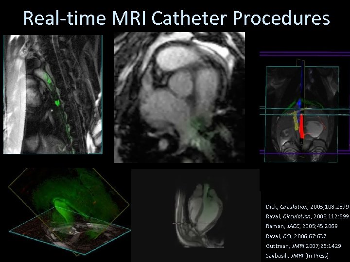 Real-time MRI Catheter Procedures Dick, Circulation, 2003; 108: 2899 Raval, Circulation, 2005; 112: 699