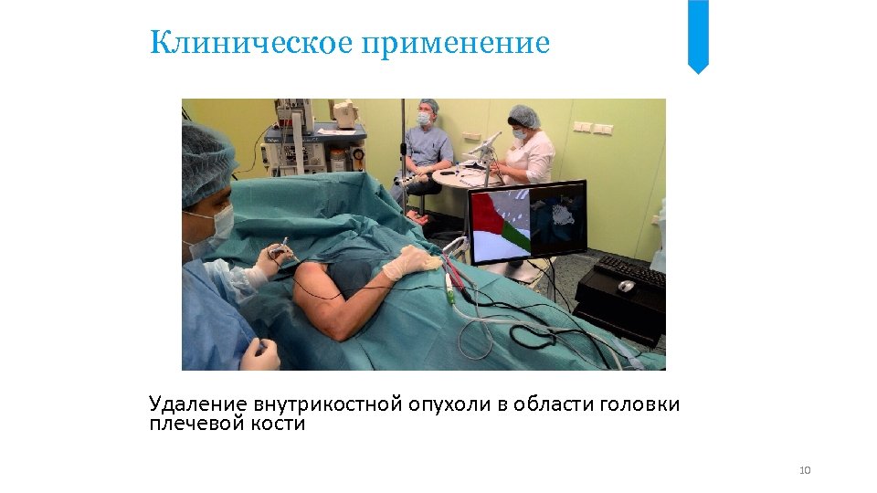 Клиническое применение Удаление внутрикостной опухоли в области головки плечевой кости 10 