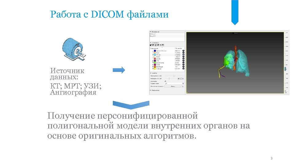 Работа с DICOM файлами Источник данных: КТ; МРТ; УЗИ; Ангиография Получение персонифицированной полигональной модели